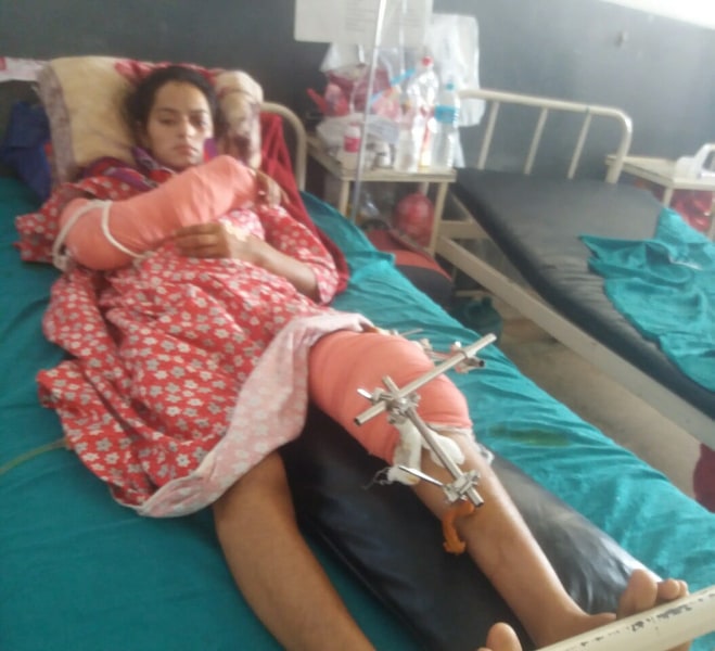 रुखबाट खसेर दायाँहात र बायाँखुट्टा भाँचिएकी सपनाको गरिबीका कारण उपचारमा समस्या