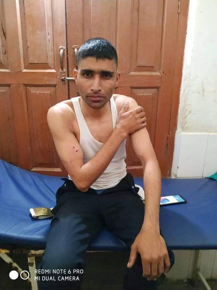 टीकापुरमा बाघको आक्रमण बाट प्रहरी जवान लगायत ३जना घाइते ।